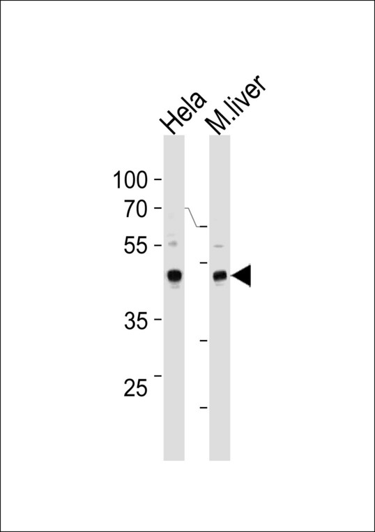 TBX6 Antibody (Center W158) western blot of HeLa cell line and mouse liver tissue lysates (35 ug/lane). The TBX6 antibody detected the TBX6 protein (arrow).