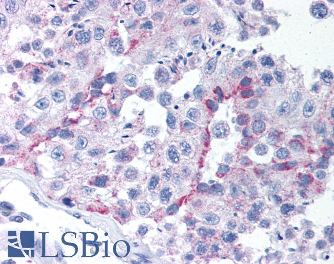 Anti-TBX6 antibody IHC of human testis. Immunohistochemistry of formalin-fixed, paraffin-embedded tissue after heat-induced antigen retrieval. Antibody LS-B911 concentration 10 ug/ml.