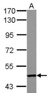Sample (30 ug of whole cell lysate) A: A549 7.5% SDS PAGE TC2N antibody diluted at 1:1000