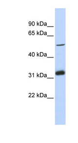 TC2N antibody LS-C102484 Western blot of MCF7 cell lysate.