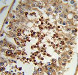 Formalin-fixed and paraffin-embedded human testis tissue reacted with TAC2N Antibody , which was peroxidase-conjugated to the secondary antibody, followed by DAB staining. This data demonstrates the use of this antibody for immunohistochemistry; clinical relevance has not been evaluated.