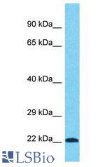 PRPF38B antibody Western Blot of HCT15. Antibody dilution: 1 ug/ml.