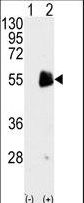 Western blot of PRMT7 (arrow) using rabbit polyclonal PRMT7 Antibody. 293 cell lysates (2 ug/lane) either nontransfected (Lane 1) or transiently transfected with the PRMT7 gene (Lane 2) (Origene Technologies).