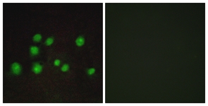 Immunofluorescence of A549 cells, using ELOA2 Antibody. The picture on the right is treated with the synthesized peptide.
