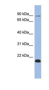 TCEB3B antibody LS-C110095 Western blot of OVCAR-3 cell lysate.