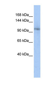 TCERG1 antibody LS-C101413 Western blot of Jurkat lysate.