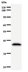 Western blot of immunized recombinant protein using TCERG1 antibody.
