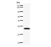 Western blot analysis of immunized recombinant protein, using anti-TCERG1 monoclonal antibody.
