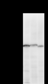 Detection of TCERG1 by Western blot. Samples: Whole cell lysate from human A2058 (H, 50 ug) , mouse NIH3T3 (M, 50 ug) and rat F2408 (R, 50 ug) cells. Predicted molecular weight: 123 kDa