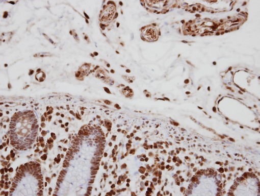 IHC of paraffin-embedded Colon, using CA150 antibody at 1:250 dilution.