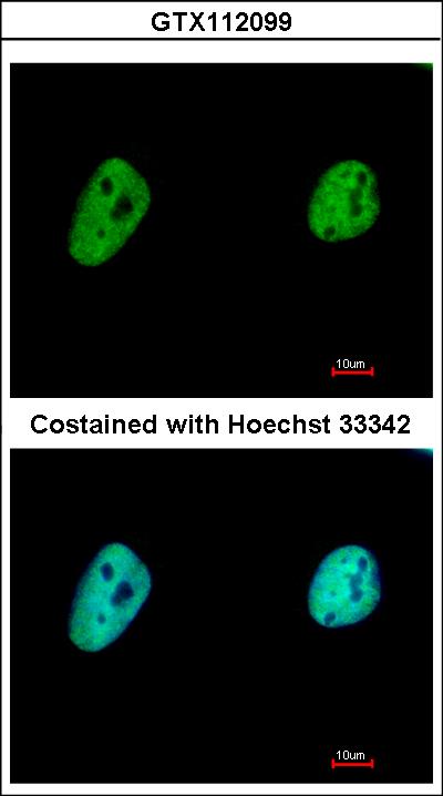 Immunofluorescence of paraformaldehyde-fixed HeLa, using CA150 antibody at 1:500 dilution.