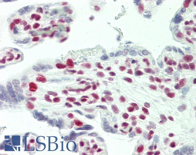 Anti-TCERG1 / CA150 antibody IHC staining of human placenta. Immunohistochemistry of formalin-fixed, paraffin-embedded tissue after heat-induced antigen retrieval. Antibody LS-B11296 concentration 5 ug/ml.