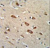 Formalin-fixed and paraffin-embedded human brain tissue reacted with TCERG1L Antibody , which was peroxidase-conjugated to the secondary antibody, followed by DAB staining. This data demonstrates the use of this antibody for immunohistochemistry; clinical relevance has not been evaluated.