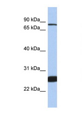 NFE2L1 antibody LS-C145201 Western blot of 1 Cell lysate. Antibody concentration 1 ug/ml.