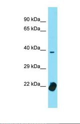 Western blot of Human Uterus Tumor. TCF12 antibody dilution 1.0 ug/ml.