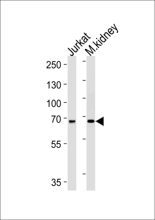 TCF12 Antibody western blot of Jurkat cell line and mouse kidney lysates (35 ug/lane). The TCF12 antibody detected the TCF12 protein (arrow).