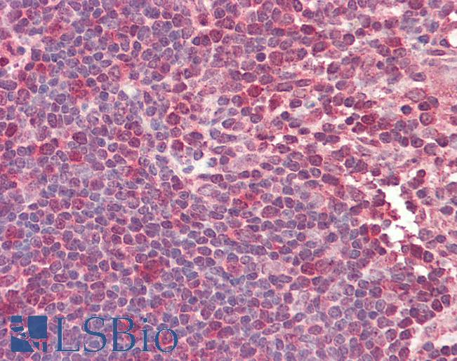 Anti-TCF12 / HEB antibody IHC staining of human thymus. Immunohistochemistry of formalin-fixed, paraffin-embedded tissue after heat-induced antigen retrieval. Antibody LS-B10267 concentration 5 ug/ml.