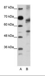 A: Marker, B: Jurkat Cell Lysate