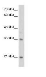 Jurkat Cell Lysate