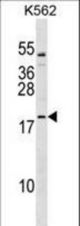 TCF15 Antibody western blot of K562 cell line lysates (35 ug/lane). The TCF15 antibody detected the TCF15 protein (arrow).