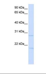Transfected 293T cell lysate. Antibody concentration: 1.0 ug/ml. Gel concentration: 12%.