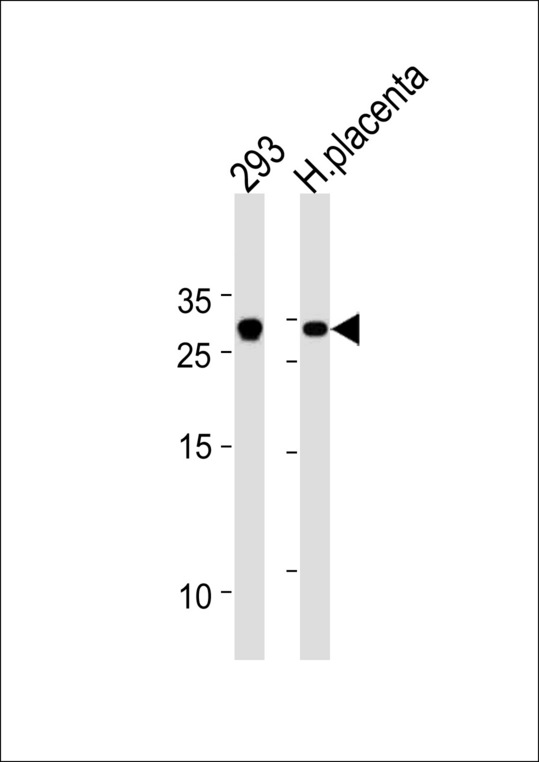 TCF21 Antibody western blot of 293 cell line and human placenta tissue lysates (35 ug/lane). The TCF21 antibody detected the TCF21 protein (arrow).