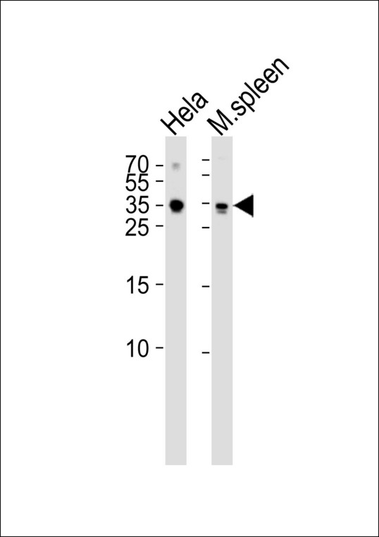 Western blot of lysates from HeLa cell line mouse spleen tissue lysate(from left to right), using TCF21 Antibody. Antibody was diluted at 1:1000 at each lane. A goat anti-rabbit IgG H&L (HRP) at 1:5000 dilution was used as the secondary antibody. Lysates at 35ug per lane.