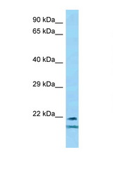 TCF23 antibody LS-C146459 Western blot of Mouse Spleen lysate. Antibody concentration 1 ug/ml.