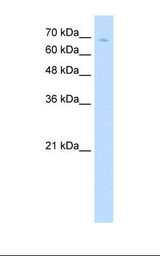 Jurkat cell lysate. Antibody concentration: 5.0 ug/ml. Gel concentration: 12%.