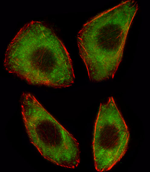 Fluorescent image of A549 cell stained with TCF25 Antibody. A549 cells were fixed with 4% PFA (20 min), permeabilized with Triton X-100 (0.1%, 10 min), then incubated with TCF25 primary antibody (1:25, 1 h at 37°C). For secondary antibody, Alexa Fluor 488 conjugated donkey anti-rabbit antibody (green) was used (1:400, 50 min at 37°C). Cytoplasmic actin was counterstained with Alexa Fluor 555 (red) conjugated Phalloidin (7units/ml, 1 h at 37°C). TCF25 immunoreactivity is localized to Cytoplasm significantly.