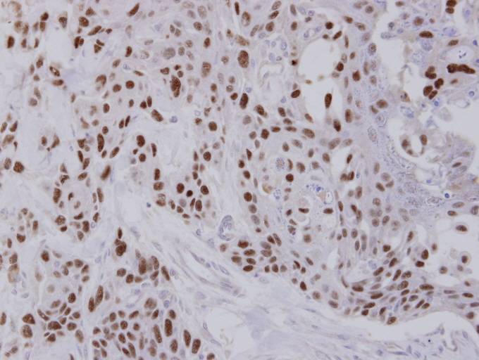 IHC of paraffin-embedded FaDu xenograft using NULP1 antibody at 1:100 dilution.
