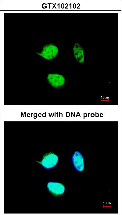 Immunofluorescence of paraformaldehyde-fixed HeLa using NULP1 antibody at 1:200 dilution.