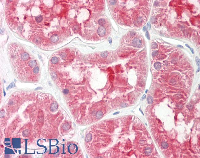 Human Kidney: Formalin-Fixed, Paraffin-Embedded (FFPE)
