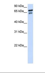 Transfected 293T cell lysate. Antibody concentration: 1.0 ug/ml. Gel concentration: 12%.