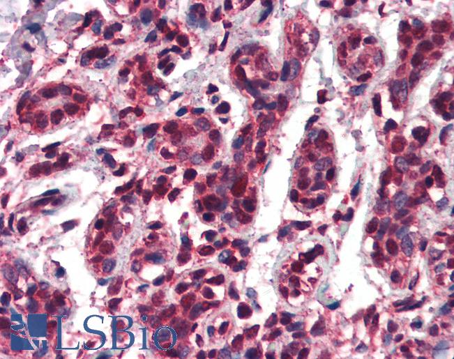 Anti-TCF3 antibody IHC of human breast. Immunohistochemistry of formalin-fixed, paraffin-embedded tissue after heat-induced antigen retrieval. Antibody LS-B3248 concentration 75 ug/ml.