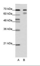 A: Marker, B: HepG2 Cell Lysate