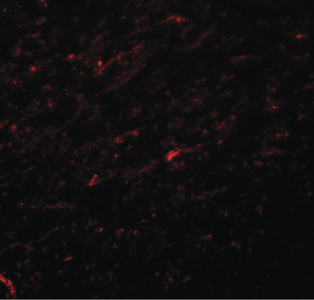 Immunofluorescence of TCF3 in rat brain tissue with TCF3 antibody at 20 ug/ml.