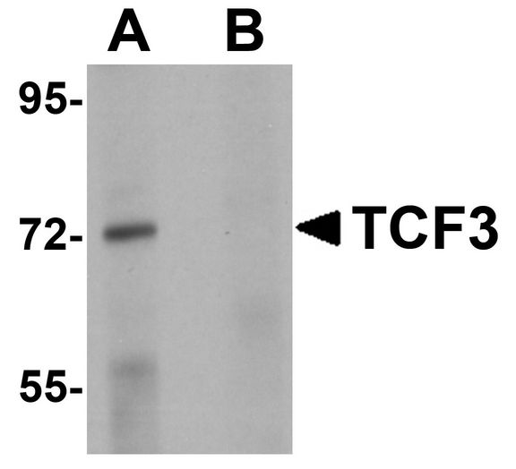 Western blot analysis of TCF3 in Human brain tissue lysate with TCF3 antibody at 1 ug/ml in (A) the absence and (B) presence of peptide blocking.