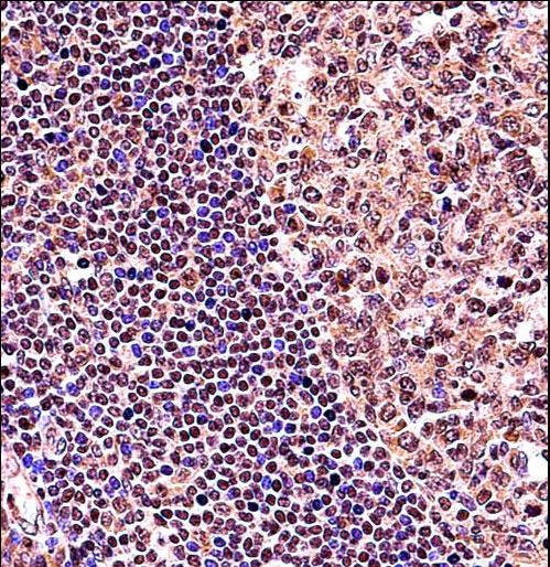 TCF3 Antibody immunohistochemistry of formalin-fixed and paraffin-embedded human tonsil tissue followed by peroxidase-conjugated secondary antibody and DAB staining.