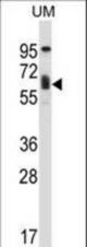 TCF3 Antibody western blot of human uterine tumor tissue lysates (35 ug/lane). The TCF3 antibody detected the TCF3 protein (arrow).