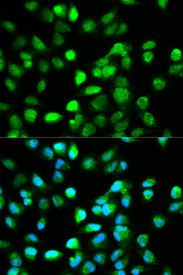 Immunofluorescence analysis of HeLa cell using TCF4 antibody. Blue: DAPI for nuclear staining.