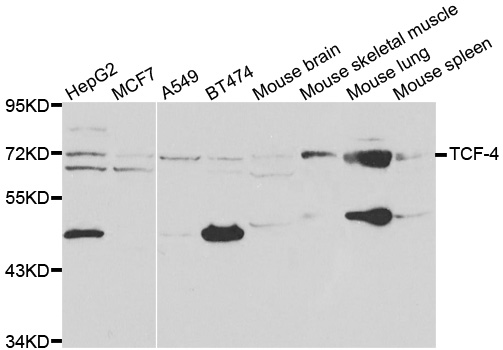 Western blot analysis of extracts of various cell lines, using TCF4 antibody.