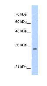 TCF4 antibody LS-B1570 Western blot of HepG2 cell lysate.