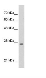 HepG2 Cell Lysate