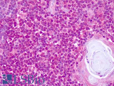Human, Thymus: Formalin-Fixed Paraffin-Embedded (FFPE)
