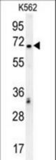 TCF4 Antibody western blot of K562 cell line lysates (35 ug/lane). The TCF4 antibody detected the TCF4 protein (arrow).