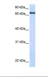 293T cell lysate. Antibody concentration: 1.0 ug/ml. Gel concentration: 12%.