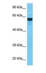 Western blot of TF7L1 Antibody with human Lung Tumor lysate.