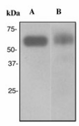 Western blot analysis on (A) A431 and (B) fetal small intestine lysates using anti-TCF-3 antibody (LS-C105549), dilution 1:2000.