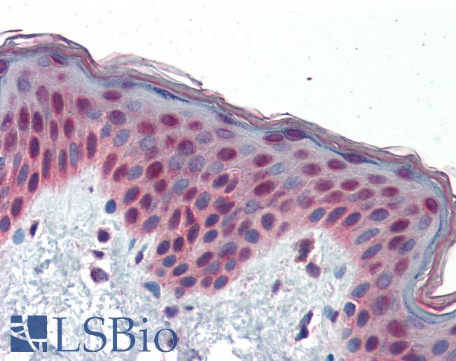 Anti-TCF7L1 antibody IHC of human skin. Immunohistochemistry of formalin-fixed, paraffin-embedded tissue after heat-induced antigen retrieval. Antibody LS-B3476 concentration 5 ug/ml.